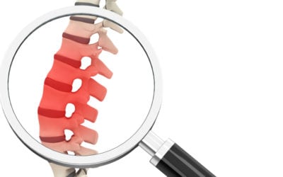The 3 Most Common Reasons Why a Spinal Disc Slips