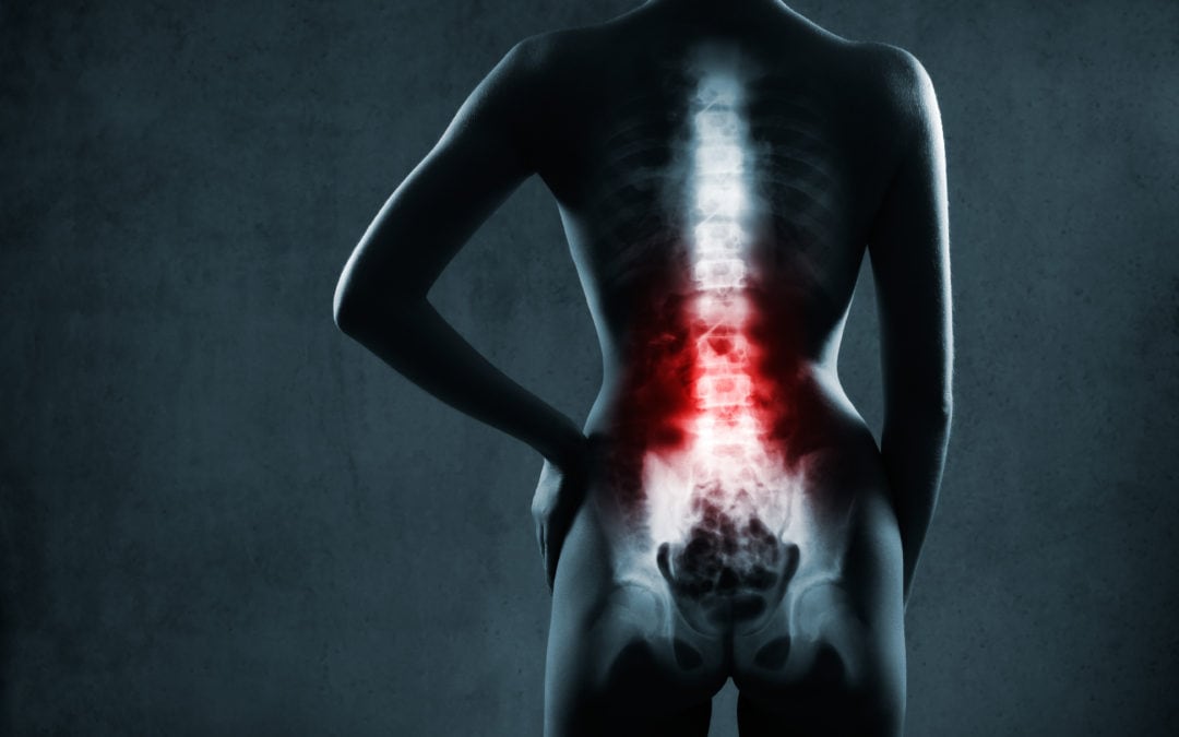 spinal stenosis pain