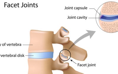 Facet Joint Arthritis: Everything You Need to Know